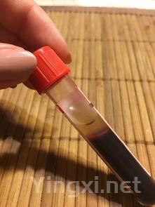 哪种戒烟产品最好,最好用的戒烟产品